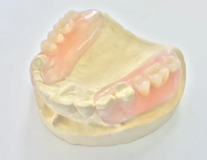 ノンクラスプデンチャー